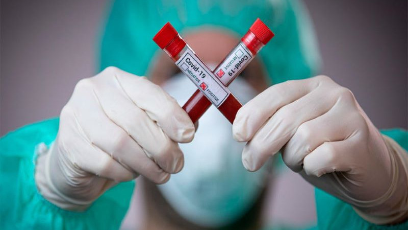 соңғы тәулікте 2480 адам коронавирус инфекциясын жұқтырды