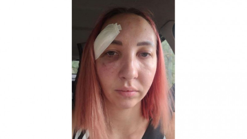 Алматыда белгісіз ер адам көшеде қызды соққыға жықты